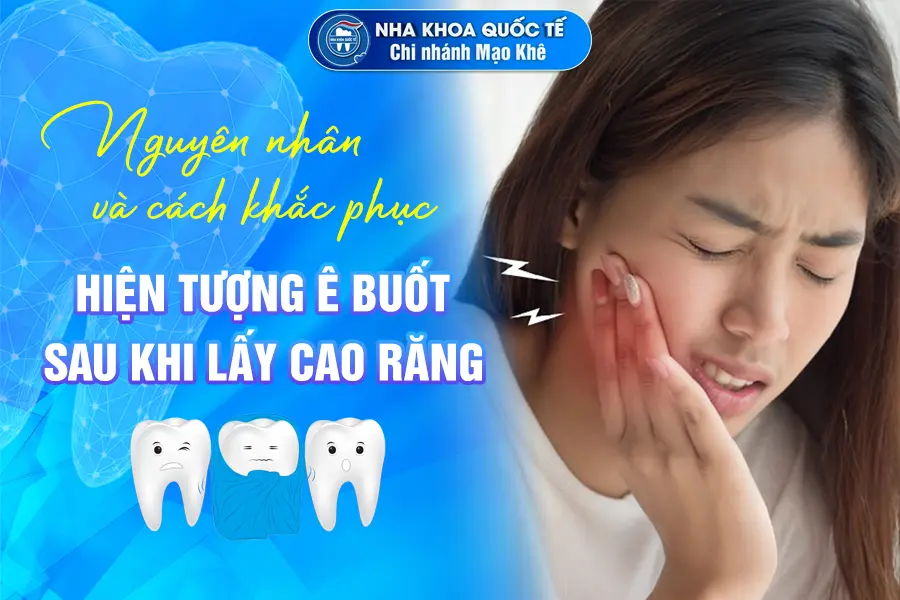 ê buốt sau khi lấy cao răng
