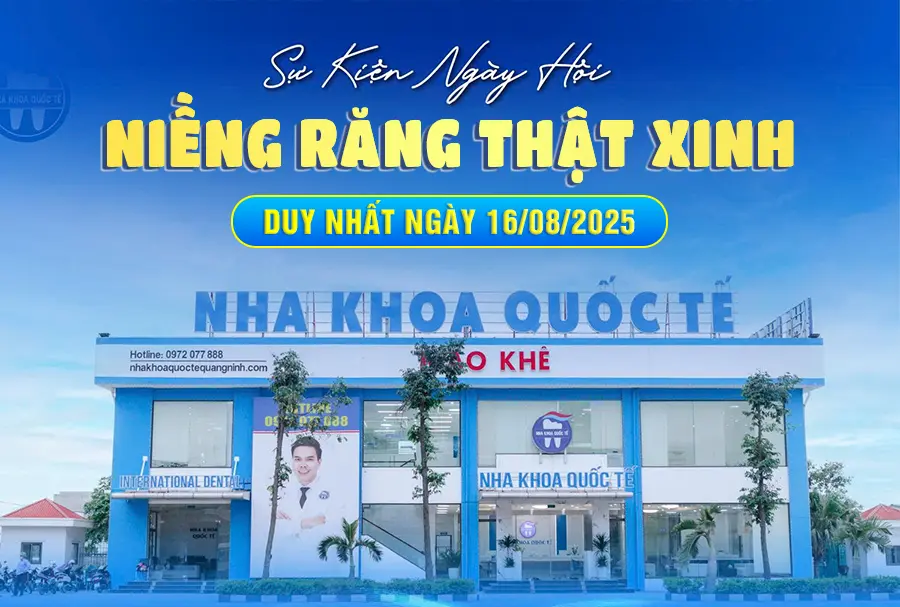 sự kiện niềng răng xinh