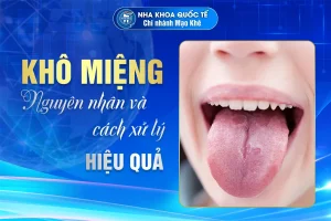 xử lý khô miệng