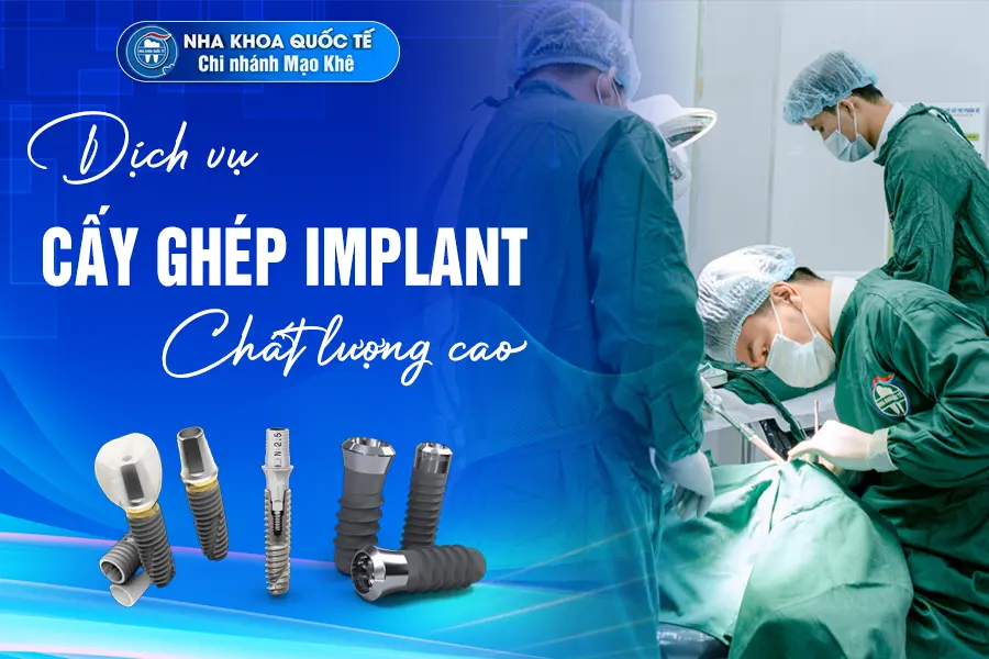 Dịch vụ cấy ghép implant mạo khê