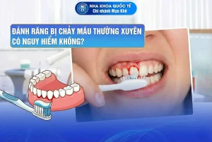 đánh răng bị chảy máu