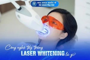 Tẩy trắng răng Laser Whitening là gì