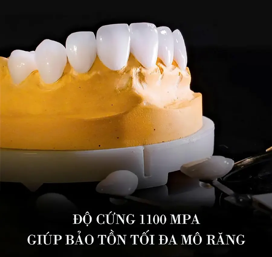 Độ cứng răng sứ Lava
