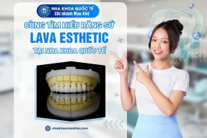 tìm hiểu răng sứ lava