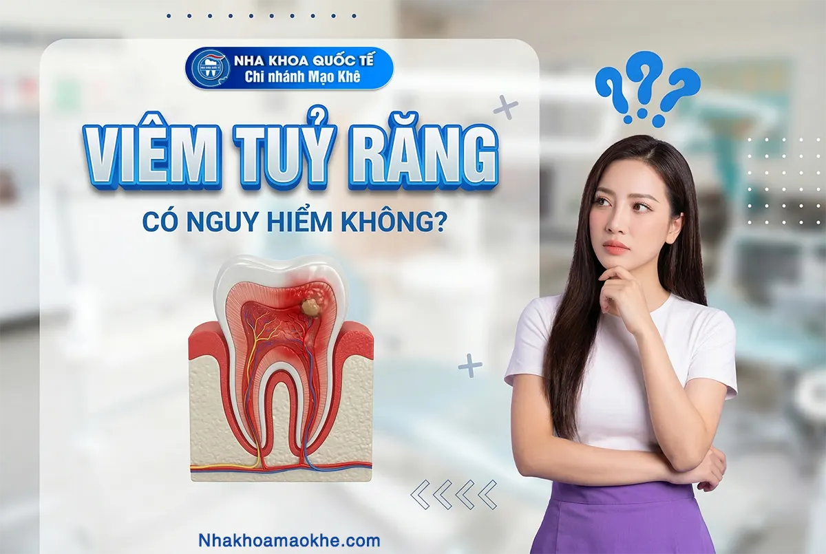viêm tủy răng nguy hiểm