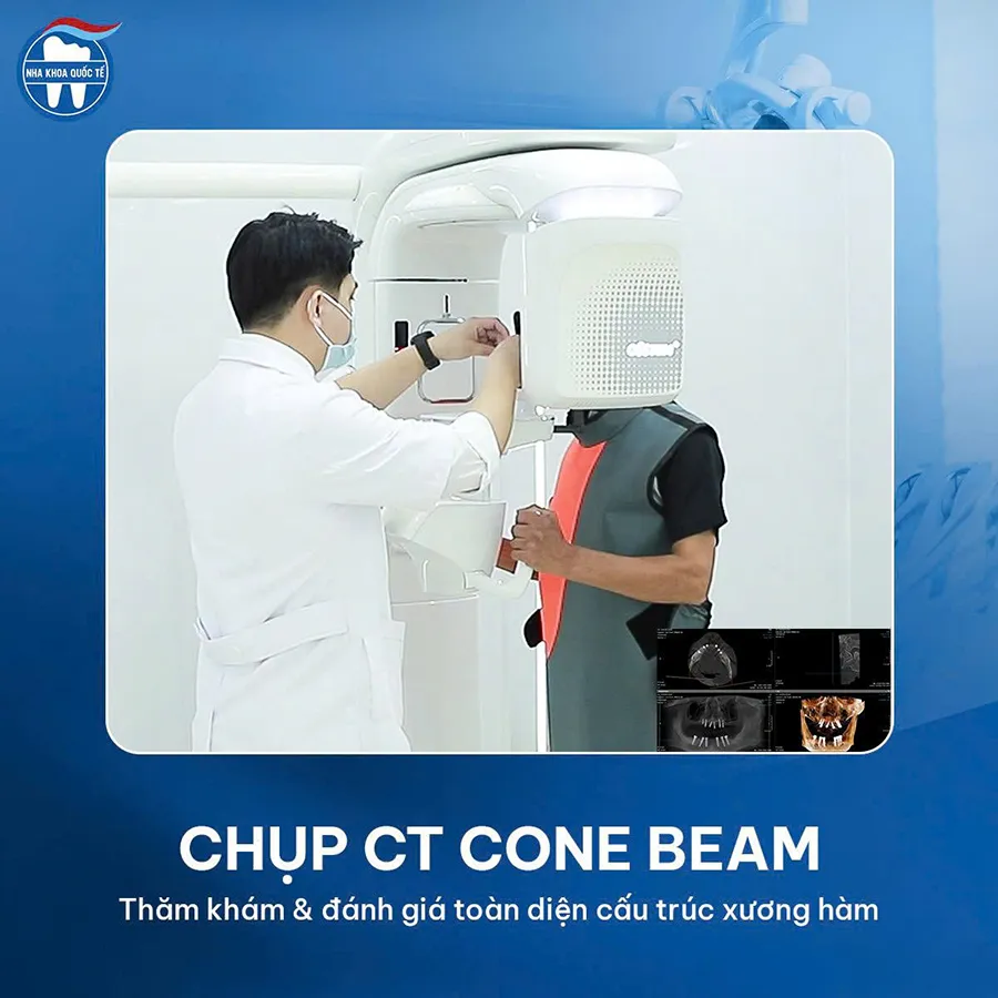 chụp ct cone beam