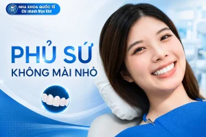 phủ sứ không mài nhỏ răng