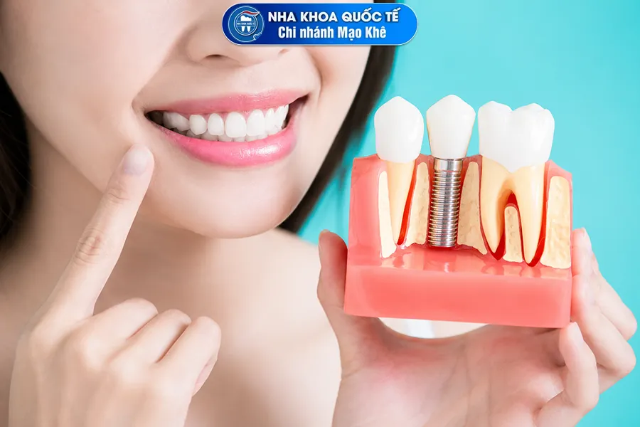 thẩm mỹ từ implant