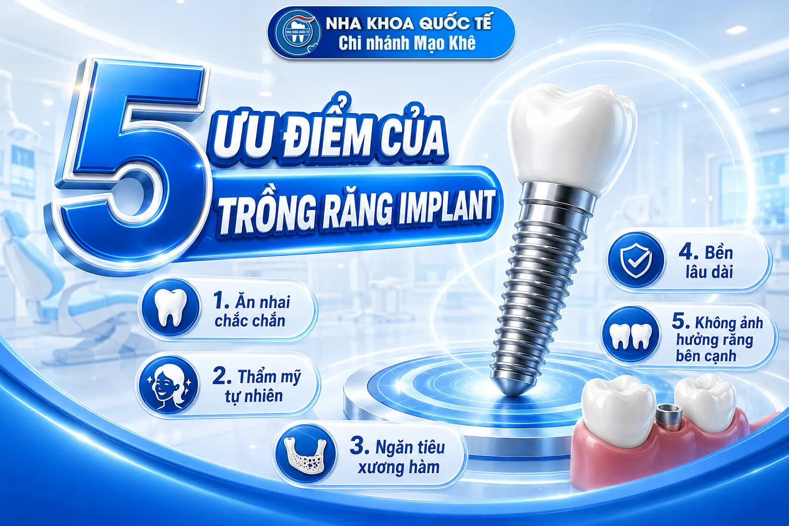 ưu điểm của trồng implant
