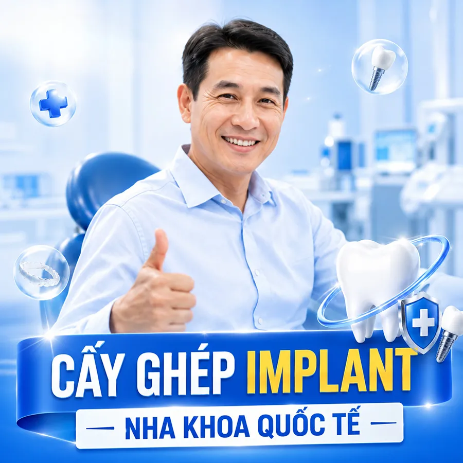 Cấy ghép Implant nha khoa quoc te
