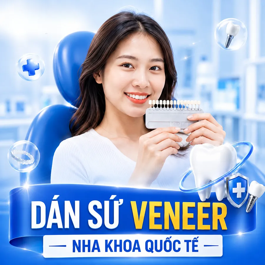 dán sứ veneer