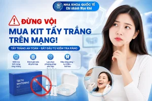 cẩn thận khi tẩy trắng răng