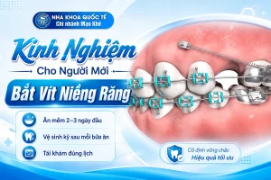 kinh nghiệp cho người mới bắt vít niềng răng