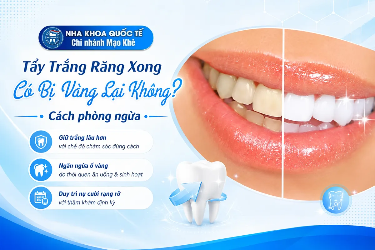 tẩy trắng xong bị vàng lại ko